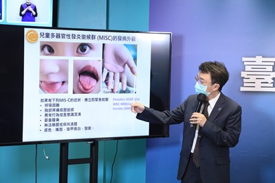 圖片說明：中國醫藥大學兒童醫院院長王志堯出席說明MIS-C症狀、發病時間。(記者謝榮浤翻攝)