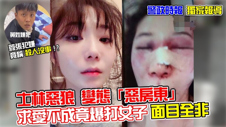 辣媽來台探親租屋慘遭二房東暴打毀容|死裡逃生泣訴:黃洺軒說他殺了我也不會有事