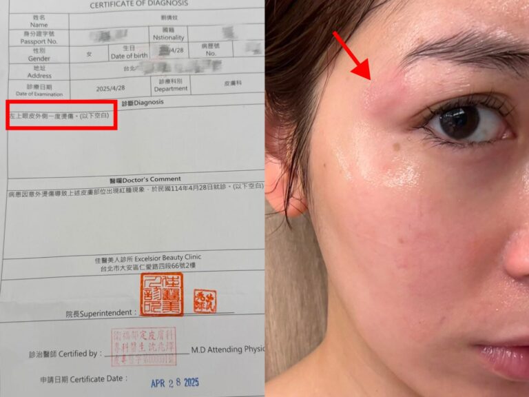 劉倩妏秀出燙傷照及一度燙傷的診斷證明書。（本報合成照片）